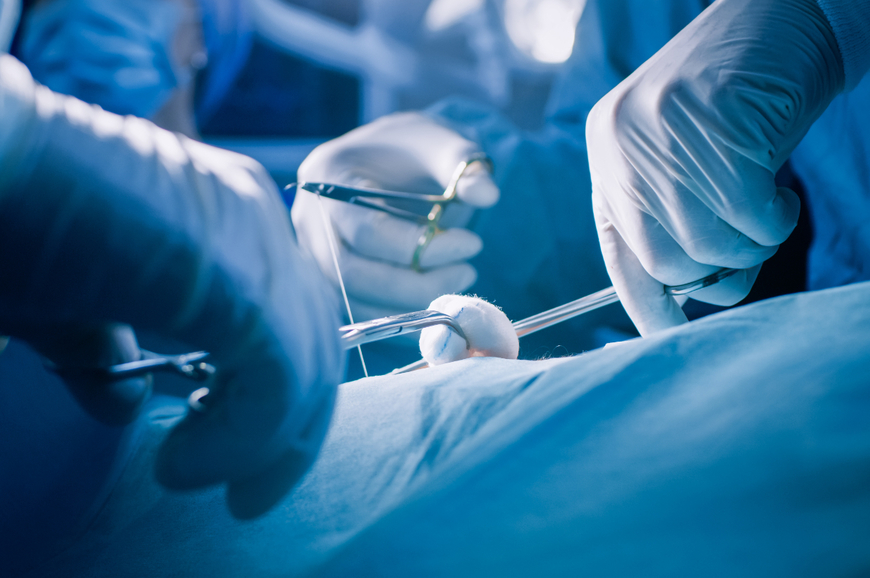 Виды перчаток